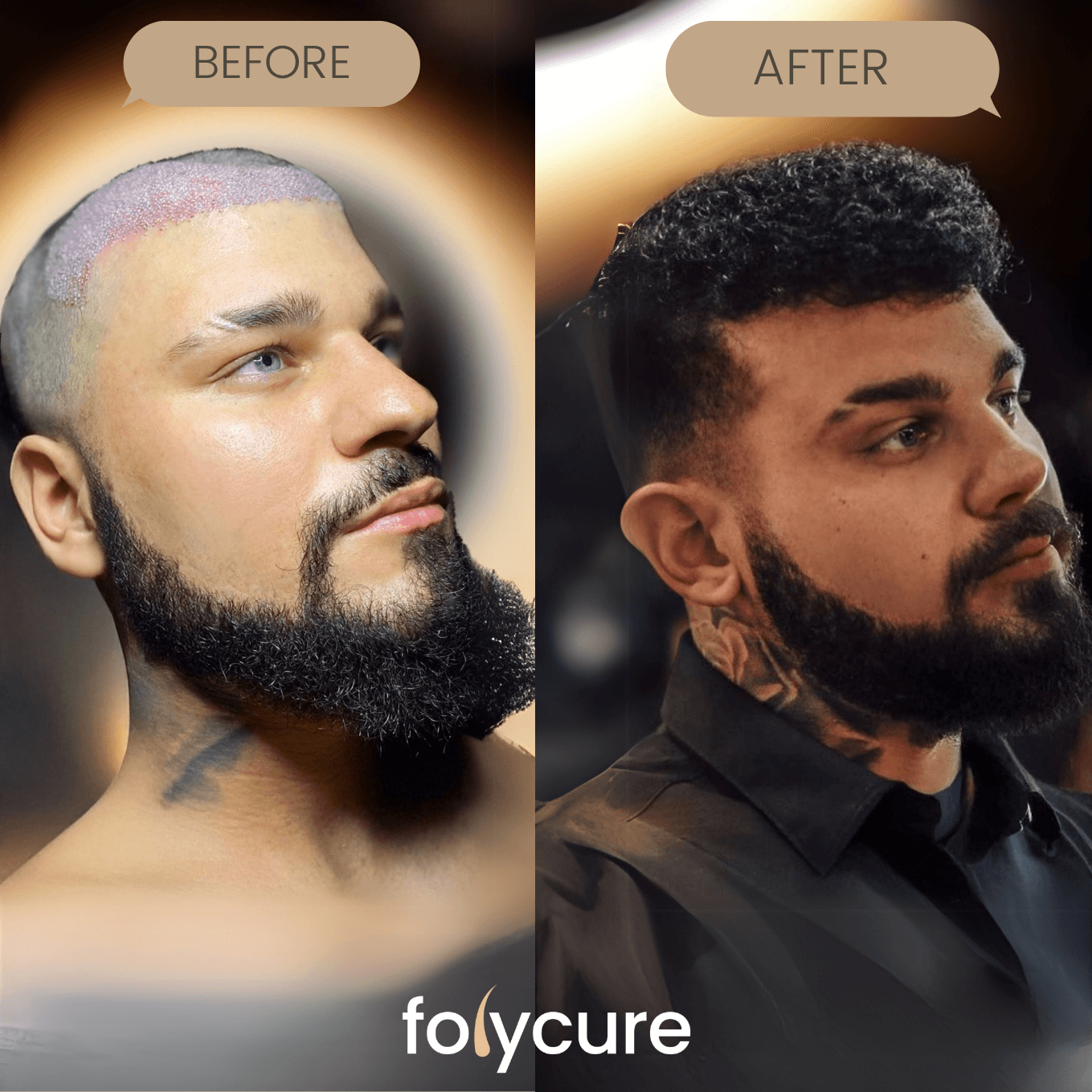 Before and after example