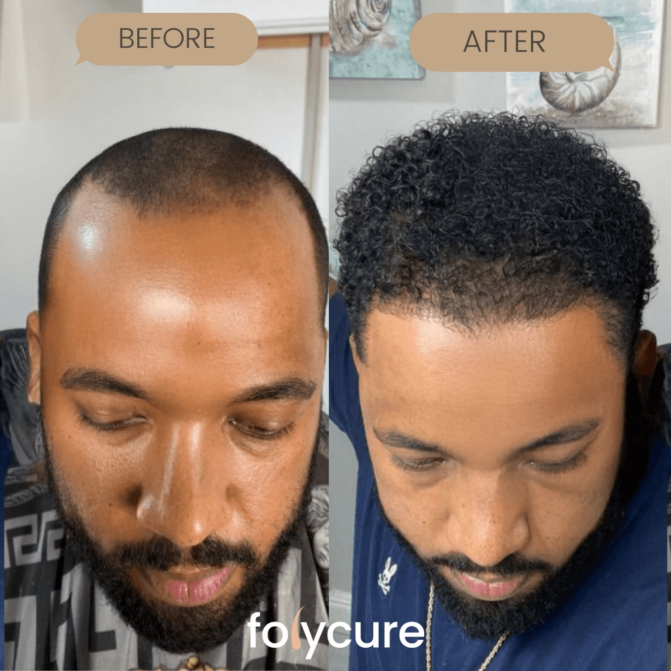 Before and after example