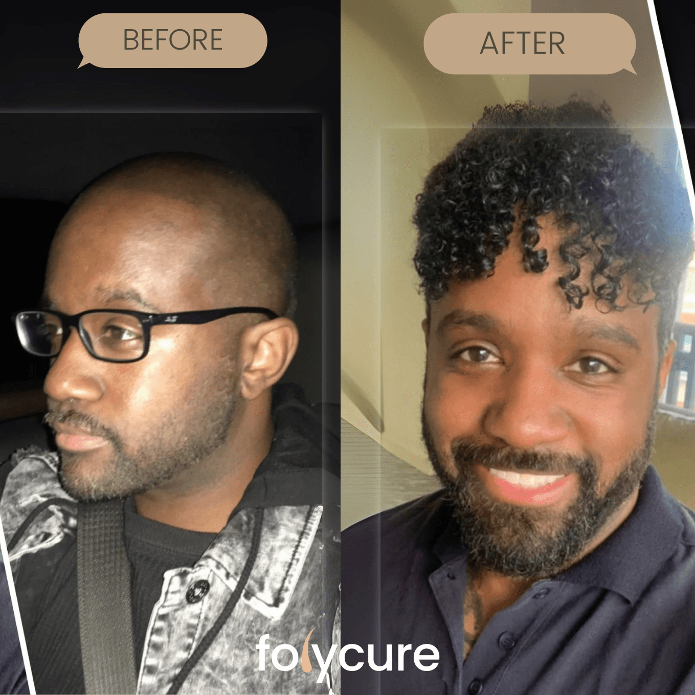 Before and after example