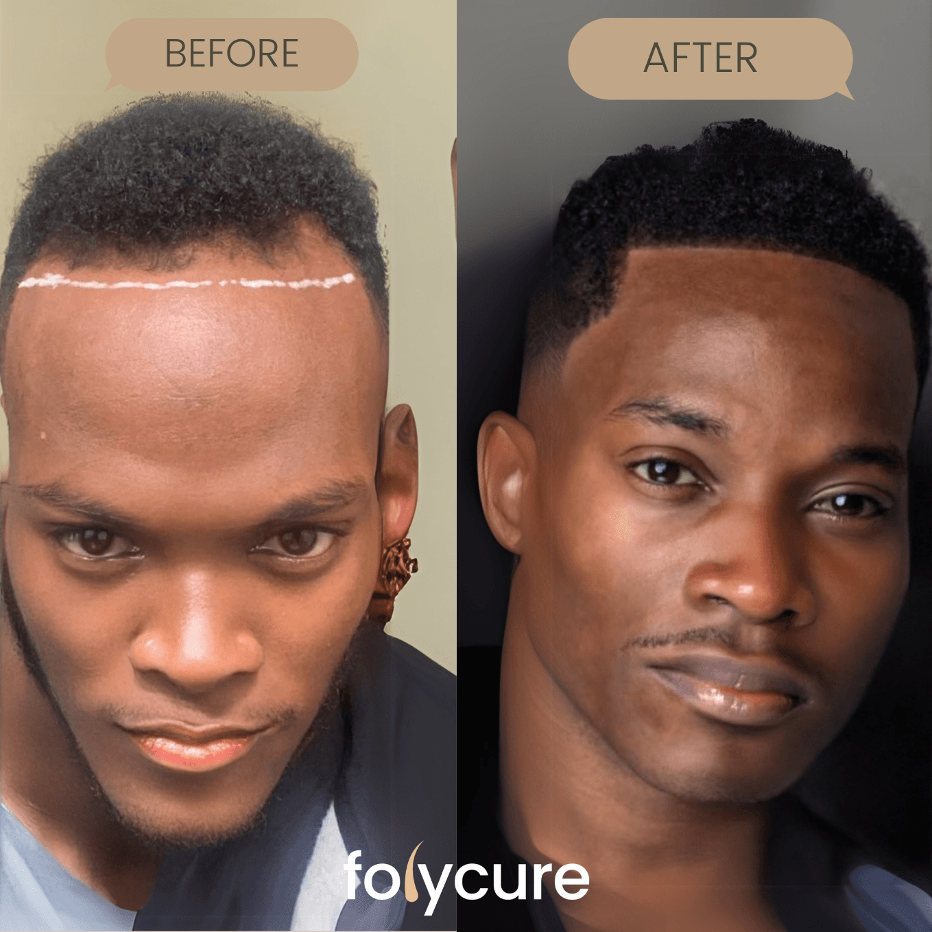 Before and after example