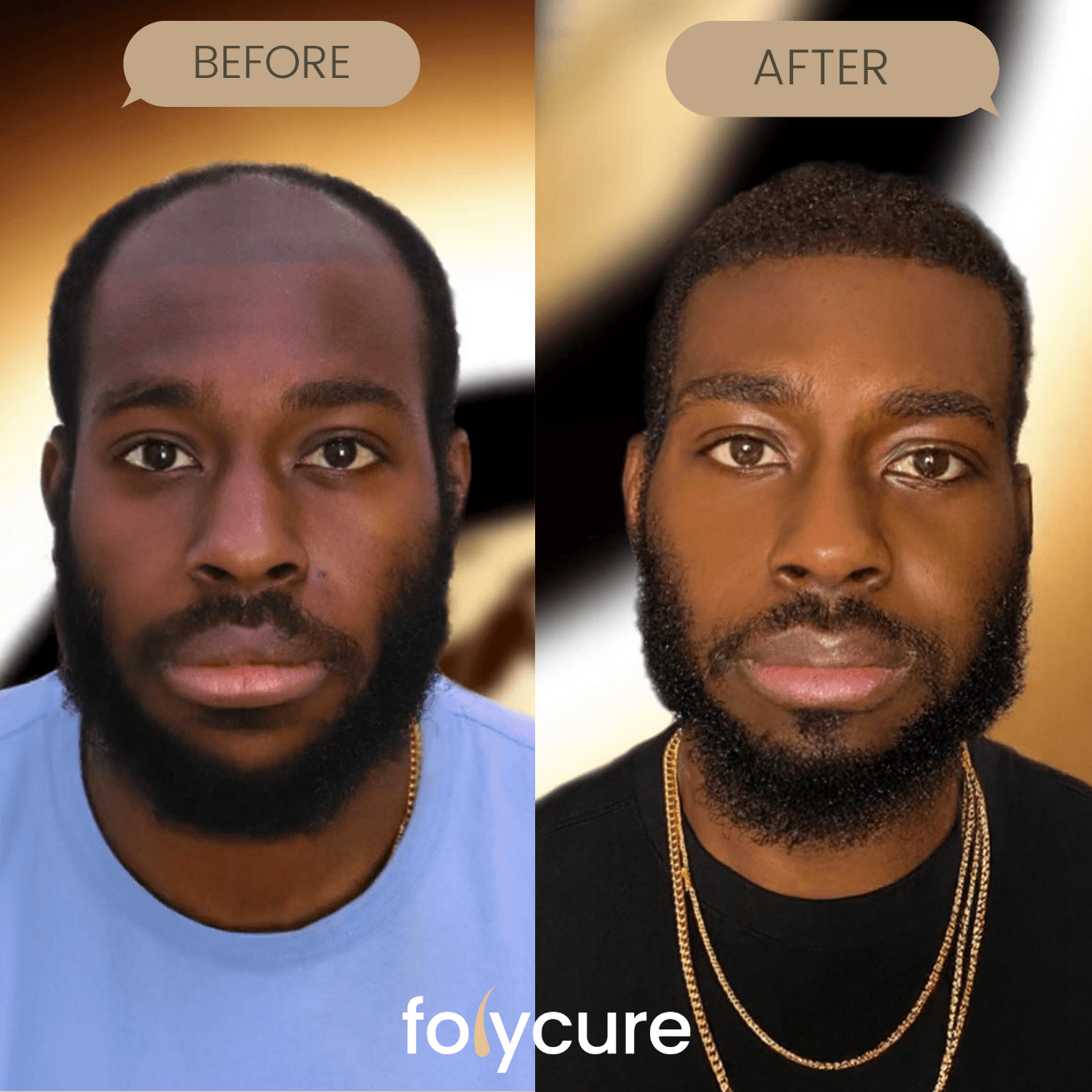 Before and after example