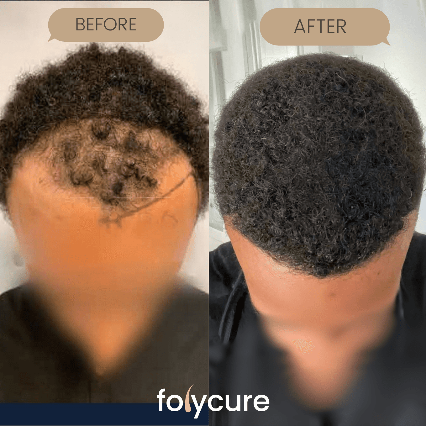 Before and after example