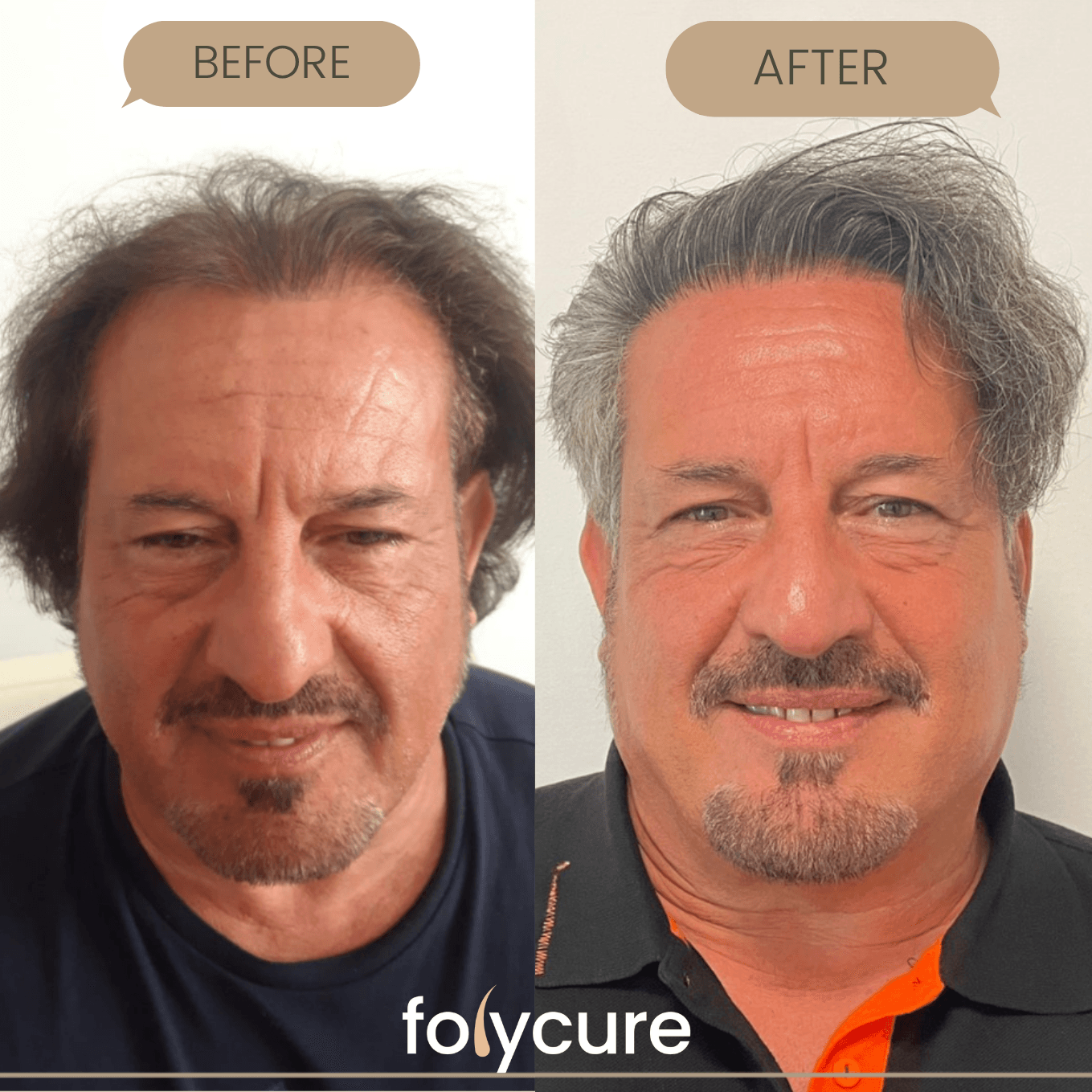 Before and after example