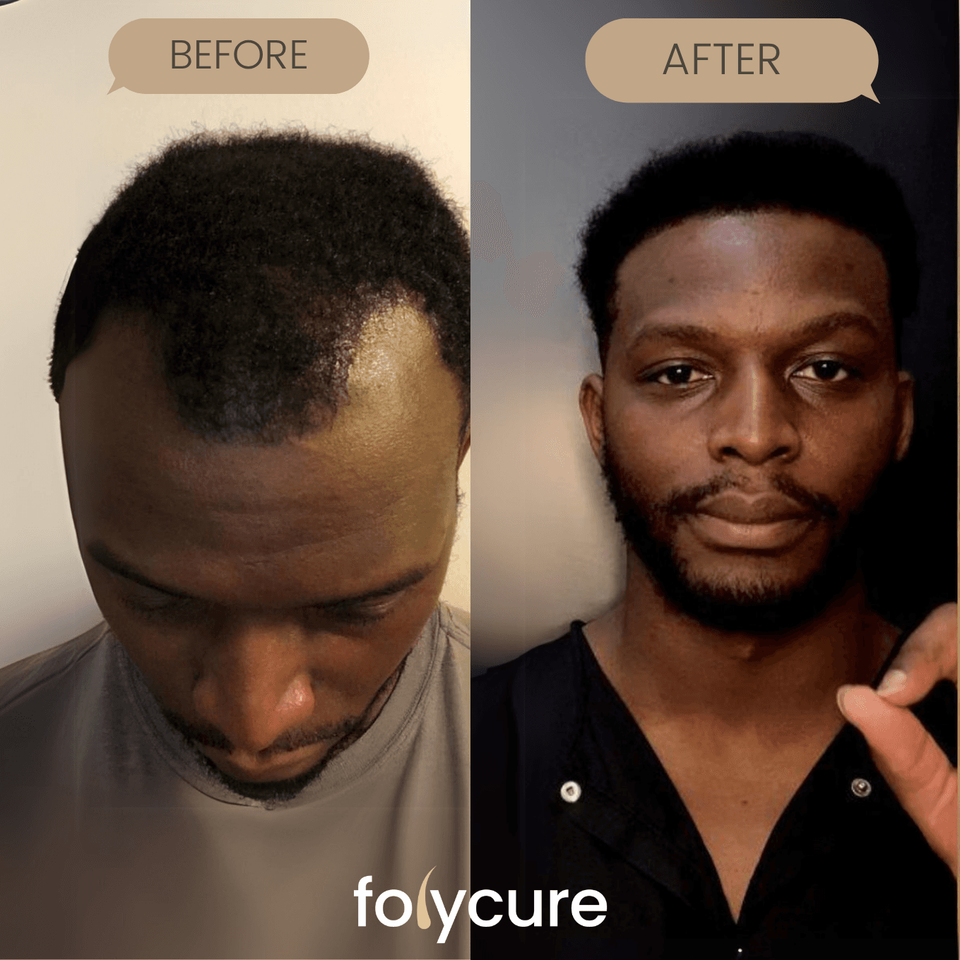 Before and after example